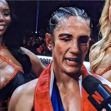 Serrano #SerranoGotRobbed The best fight last night, HANDS DOWN, was the  #SerranoFight My respect for professional fighters went through the roof  last night. And the undercard before the Taylor/Serrano fight was a