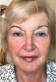 Dr Amy Law Cosmetic Clinic Liverpool