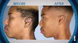 A couple of weeks ago