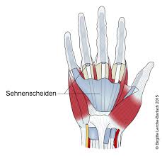 Quervain Krankheit Tendovaginitis Stenosans De Quervain Deximed