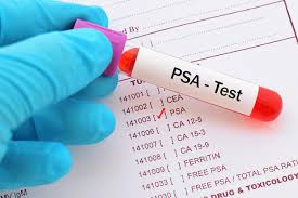 Check spelling or type a new query. Psa Screening Benefits Disadvantages And Guidelines University Health News