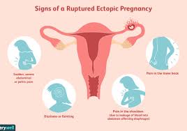 One that involves an incision, and another that is done without a scalpel or any cutting. Ruptured Ectopic Pregnancy Emergency Symptoms