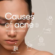 Daily Cole Skincare (@dailycole.id) • Instagram photos and videos