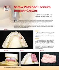 screw retained titanium Implant Crowns