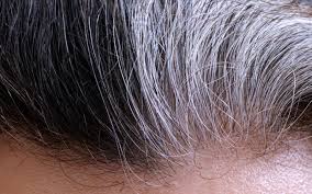 An anonymous reader quotes a report from the bbc: Scientists Discover Why Stress Turns Hair White
