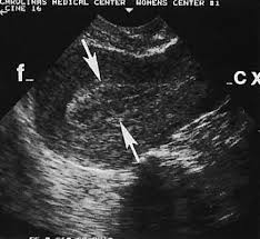 We did not find results for: Diagnostic Ultrasonography In Gynecology Glowm