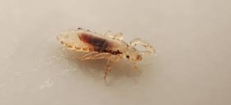 Kopflause Nissen Parasiten Am Kopf Ausfindig Machen Nyda