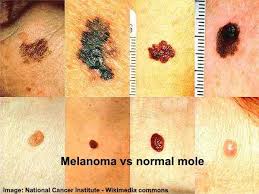 Pin On Diseasemed