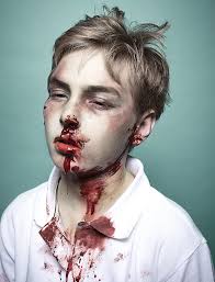 poor unfortunate boy