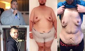 Pin On Weight Loss Wonders