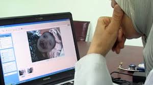 It is now known to cause cancer and birth defects. Depleted Uranium Used By Us Forces Blamed For Birth Defects And Cancer In Iraq Rt World News