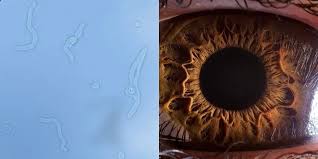 What Are Those Eye Floaters Eyefloaterscauses Eye Floaters Causes What Causes Eye Floaters Eye Floaters Cure