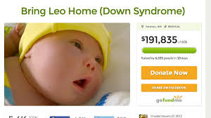 Screening for down syndrome is now routinely offered in many developed countries. Ultimatum Wegen Baby Mit Downsyndrom Ehemann Verlassen Welt