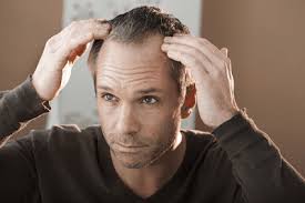 Over the long term, high blood sugar levels can damage hair follicles and potentially accelerate hair loss. Can Diabetes Cause Hair Loss Here S How You Can Stop It