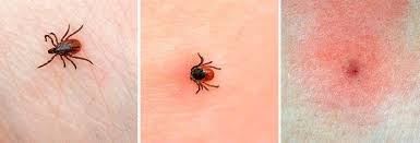 Chto Delat Esli Ukusil Klesh