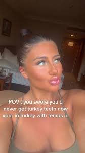 Avoid Turkey Teeth in Turkey with These Dental Tips!