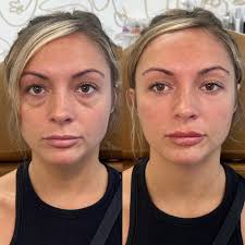 AR Aesthetics St. Petersburg: See Client Testimonials