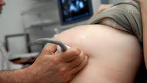 Fra 20 uker og 0 dager til 20 uker og 6 dager av svangerskapet. Ultralyd I Svangerskapet Nhi No