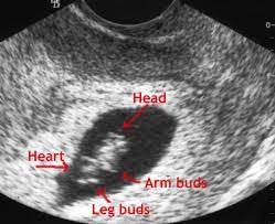 Pink mucus 7 weeks pregnant : 7 Weeks Pregnant Might Be Some Mucus