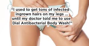 An ingrown hair occurs when a shaved or tweezed hair grows back into the skin. 10 Products That Get Rid Of Ingrown Hairs Tried And Proven By Actual People