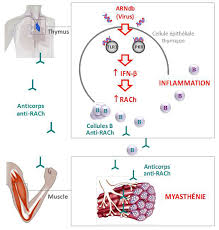 Check spelling or type a new query. Auto Immune Disease The Viral Route Is Confirmed Newsroom Inserm