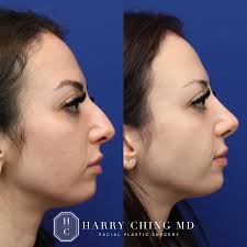 Harry Ching MD (@harrychingmd) • Instagram photos and videos