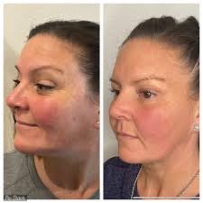 Evergreen Aesthetics