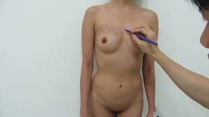 Leaked amateur plastic surgery video is rather impressive for watching -  Mylust.com Video