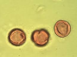 Image result for Euclea undulata