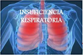 CONTRAINDICACIONES