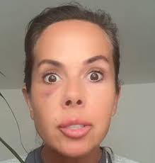 Nasty Nasty Nasty MARCELO AND NEVER LETTING ALI REPLY