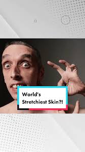 World's Stretchiest Skin?! #didyouknow #funfact #story #anecdote #edutok  #information #info #new #skin #stretching #guinnessworldrecords
