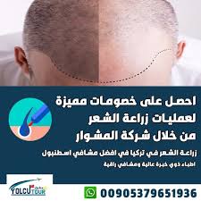 زراعة الشعر في تركيا