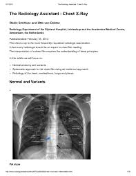 A clamp is guided beneath the sternum to create a tunnel for the bar (a), which is then fed through (b). The Radiology Assistant Chest X Ray Basic Interpretation