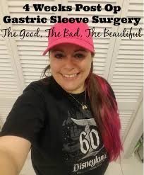 4 weeks post op gastric sleeve surgery
