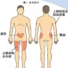 中華民國教育部版權所有© 2015 ministry of education, r.o.c. ä¸‰è§'è‚Œçš®ä¸‹æ³¨å°„ä½ç½®å›¾ æœç‹—å›¾ç‰‡æœç´¢