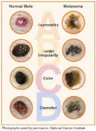 For the first time, medical researchers can access a. Skin Cancer Prevention Early Detection Bermuda Cancer And Health