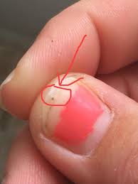 Seed Ticks Are A Thing You Probably Didn T Know You Need To Avoid Self