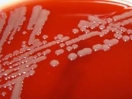 Image result for Rhizobium radiobacter, syn. Agrobacterium tumefaciens