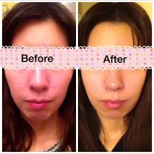 Suggest me a glow up subliminal female effective one from which you have seen results. Subliminal Results Before And After Amino