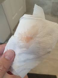 Also, the color often varies from pink to red to brown. Light Pink Discharge After Sex 34 Weeks Babycentre
