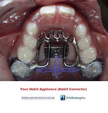 Tongue Stop Photo Orthotropics Convenience Store Products Convenience Store Convenience