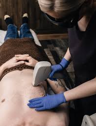 Even if some hair grows back, it should be less noticeable as well as finer and lighter than it was before your treatments. Man At The Gate Laser Hair Removal Treatments For Men