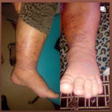 Prof Dr Ahmet Akgul Yara Bakimi Hakkinda Once Bunlari Bilmeliyiz