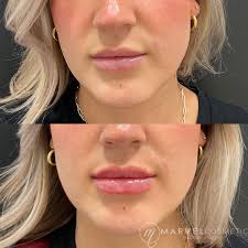 T A Y L O R B L O W, P A