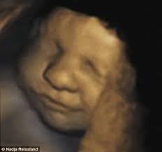 Ollie Mcbride's Instagram, Twitter & Facebook