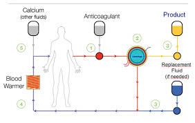 Image result for Apheresis