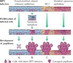 The epithelium pictured here is ciliated and possesses unicellular glands that secrete mucus, called goblet cells. Https Onlinelibrary Wiley Com Doi Pdf 10 1002 Lio2 242
