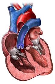 Image result for Cor Pulmonale