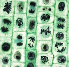 Mitotic cell division in plants is a dynamic process playing a key role in plant morphogenesis, growth, and development. Mitosis Photograph By Steve Gschmeissner Science Photo Library
